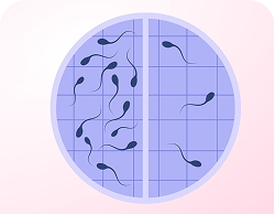 Low Sperm Count Illustration